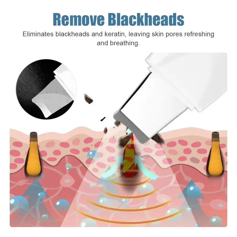 Blackhead Remover Scrubber
