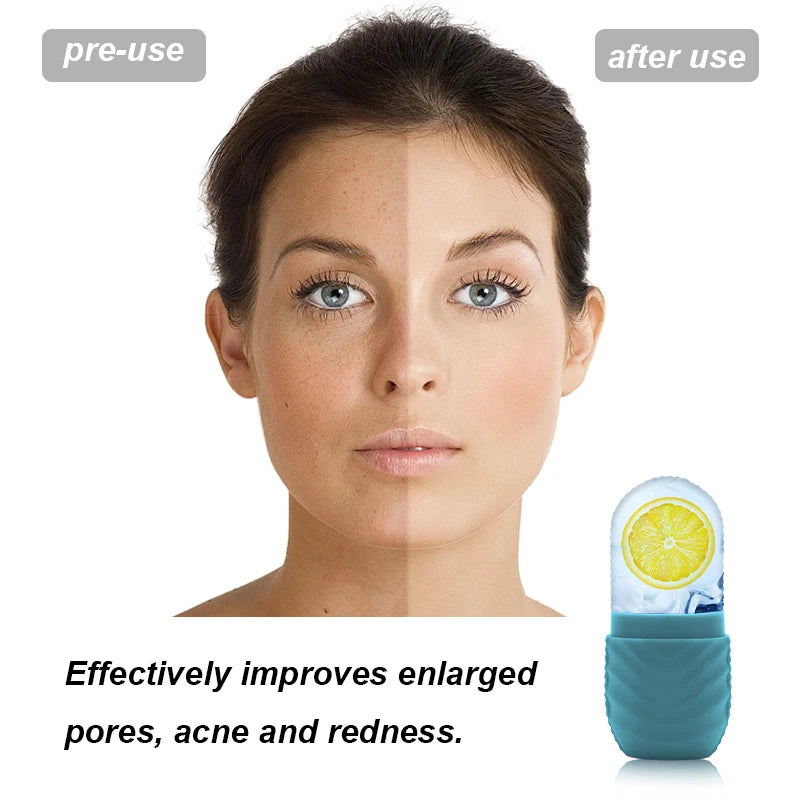 Silicone Ice Face Massager